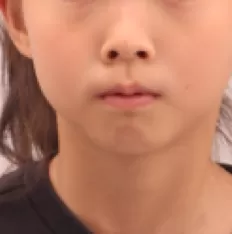 Photos faciales avant le traitement