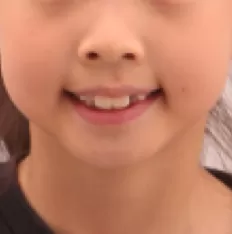 Photos faciales avant le traitement