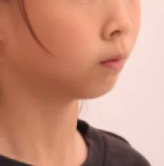 Photos faciales avant le traitement