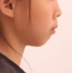 Photos faciales avant le traitement