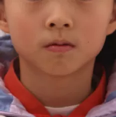 Photos faciales avant le traitement