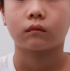 Photos faciales avant le traitement