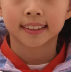 Photos faciales avant le traitement