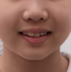 Photos faciales avant le traitement