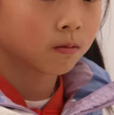 Photos faciales avant le traitement