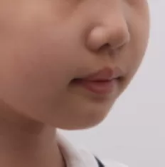 Photos faciales avant le traitement