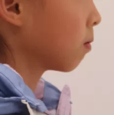 Photos faciales avant le traitement