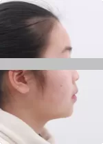 Information de base du patient et examen