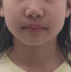 Photos faciales avant le traitement