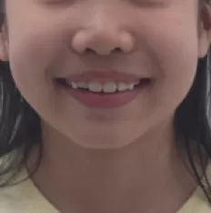 Photos faciales avant le traitement