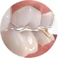 Élastique interactif